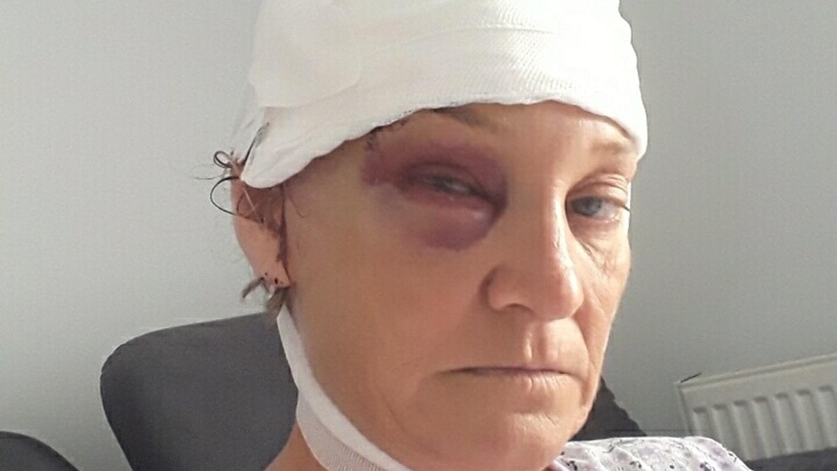 İzmir’de patronun köpeği tarafından saldırıya uğrayan kadın, davacı oldu
